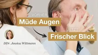 Lidstraffung: Vorher müde Augen, jetzt frischer Blick - DDr. Jessica Wittmann, Kuzbari Zentrum Wien