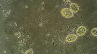 Microbial Decomposition 2