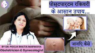 Care Women Need After Delivery | Postpartum Care ExplainedBy Dr. Pooja Bhatia Marwaha | Gurgaon