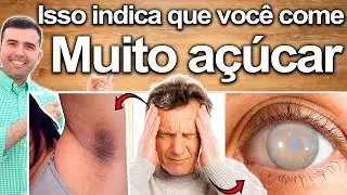 COMO SABER SE VOC&Ecirc; COME MUITO A&Ccedil;&Uacute;CAR: Sintomas Que Indicam Excesso de Doces E Como Reverter
