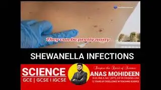 FISH SPA | SHEWANELLA INFECTIONS | SCIX SCIENCE CLASS | ANAS MOHIDEEN