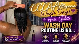 CCCA Alopecia Update + Wash Day Routine Using Rosemary & Peppermint Herbal Deep/C + Hair Growth Trio