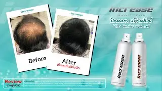 Grand INCREASE MAGIC HAIR ปิดผมบาง สร้างผมใหม่ไว้ใจ อินครีช เมจิค แฮร์  Line ID: @healthiness.in.th