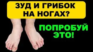 4 acupuncture points against fungus and itching