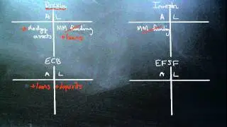 European Bank Recapitalization.wmv