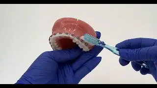 Orthodontic Home Care Instructions | Braces