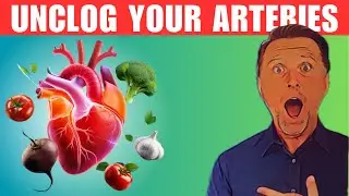 How To Unclog Arteries With THESE 5 Best Veggies ? | FitBuzz