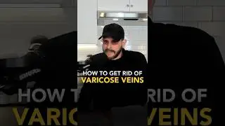 How To Get Rid of Varicose Veins