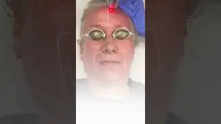 Fraxel Laser Skin Rejuvenation at Albany Cosmetic & Laser Center and medical spa in Edmonton