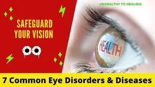 7 Common Eye Disorders & Diseases [SAFEGUARD Your VISION]