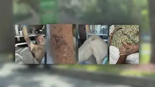 73-year-old man with dementia attacked by hospital worker at HCA Orange Park, family demands answers