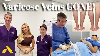 My Varicose Vein Treatment Journey | EVLA & Foam Sclerotherapy at VeinCentre
