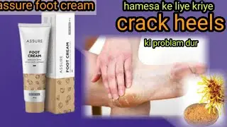 vestige Assure foot cream ||best foot cream ||crack heels || with Hazel extract
