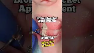 Сломались брекеты? Что делать? Читайте описание &mdash; Семейная стоматология Toothtime, Нью-Браунфелс,...