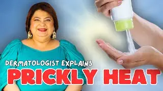 How to Prevent & Treat Prickly Heat This Summer | Dr. Shehla Agarwal Explains Heat Rash Remedies