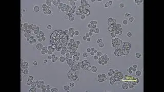 Abeoforma whisleri's coenocyte maturation