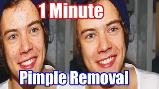How to Remove Pimples in Adobe Photoshop CC (Fast Tutorial)
