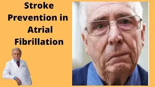 STROKE PREVENTION IN ATRIAL FIBRILLATION