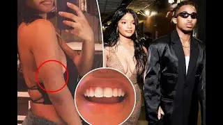 Halle Bailey Speaks Out: Rapper DDG's Shocking Abuse Allegations