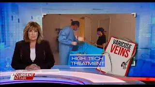 Hi-tech varicose vein treatments offer hope | A Current Affair