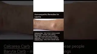 Homoeopathic Remedies for Lipoma