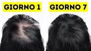 Ho Reso I Miei Capelli Più Sani E Forti In Appena Una Settimana