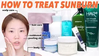 How do you treat SUN BURNED skin? | Face , Body , Scalp , Hair | Cooling & Soothing & After Care