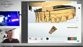 multiView registration in an articulator using a multiDie scan