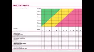 Partograph
