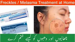 Freckles,Melasma ,Dark spots treatment |hydroquinone cream uses,side effects |san clear cream