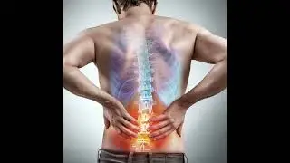Radicular Leg Pain and the Upper Cervical Spine