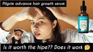 It is worth the hype or not /pilgrim advance hair growth serum 