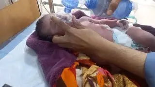 Birth Asphyxia in Newborn | Cyanosis | Emergency Resuscitation & Oxygen SupportCritical Newborn Care