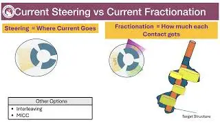 Directional Deep Brain Stimulation Explained | Steering & the Future of DBS