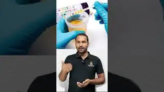 Urinary Catheterization Fundamental of Nursing| Testpaperlive #shorts #urinarycatheterization
