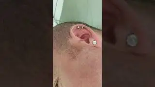 David's Double Conch Piercing