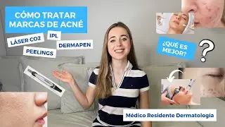 CÓMO TRATAR MARCAS DE ACNÉ EN LA CARA SEPTIEMBRE 2021 | LÁSER CO2, PEELINGS, DERMAPEN... ¿EL MEJOR?