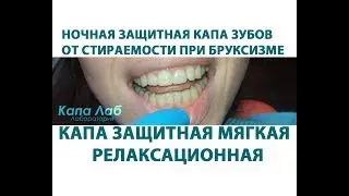 Капа от стирания зубов защитная ночная. При бруксизме. Капа стоматологическая