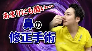 【鼻整形】修正手術の闇についてお話しします。【知らないと後悔する】@logicbeautyclinic