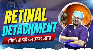 Retinal Detachment | आँखों का पर्दा उखड़ जाना | Explained by Dr. Bhanu Pangtey #retinasurgery