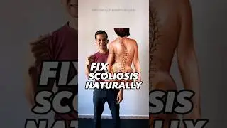 EFFECTIVE EXERCISE FOR SCOLIOSIS 🔥🔥🔥 #scoliosis #scoliosistherapy  #scoliosistreatment