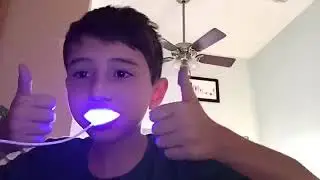 Snow Teeth Whitening Reviews