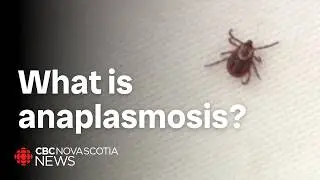 Tick-borne illness on the rise in Nova Scotia
