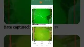 Getting started with the TLB Detection Android App