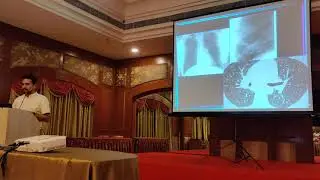 Dr Anbarasu Chest x-ray interpretation Part 2