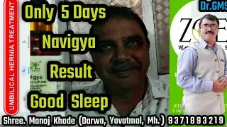 #Zoe Wellness Products Testimony Khode Sir Navigya Oil, Good Sleep, Umbilical Harniya @ 9371893219