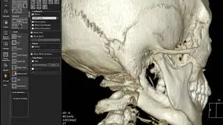 [OnDemand] 3D Ceph (Asymmetry)