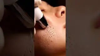 Gentle Forehead Pore Cleaning | Realistic ASMR 099