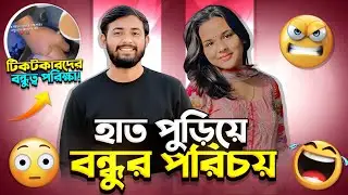 হাত পুড়িয়ে😱 টিকটকে বন্ধুর আসল পরিচয়! | Oshin Roasted🥵