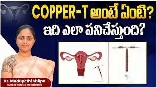 What Is Copper T? || Copper T Birth Control Explained in Telugu || Dr Shilpa Women's Clinic